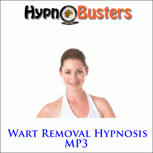 wart hypnosis